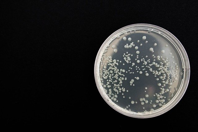 Bioburden (Mikrobiyolojik Yük) Analiz cihazı